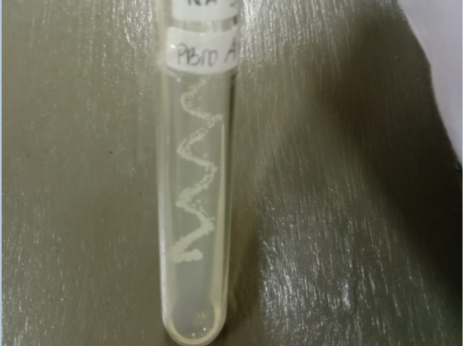 Pure culture isolation on nutrient agar plate